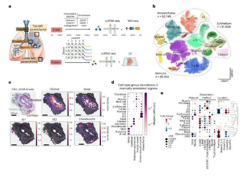 空间肺细胞图谱提供了对疾病和免疫功能的见解