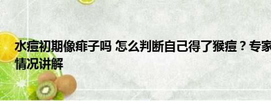 水痘初期像痱子吗 怎么判断自己得了猴痘？专家解答 基本情况讲解