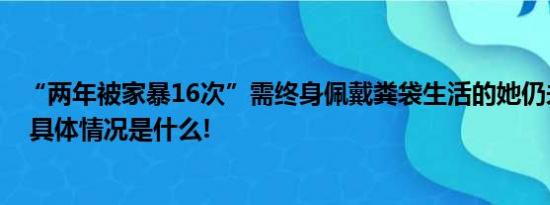 “两年被家暴16次”需终身佩戴粪袋生活的她仍未离婚成功 具体情况是什么!