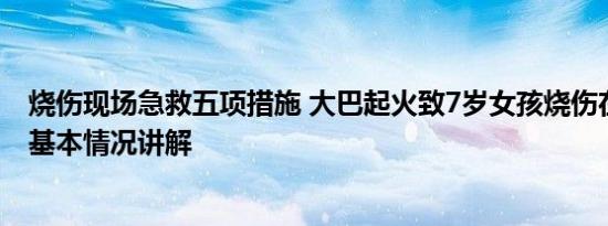 烧伤现场急救五项措施 大巴起火致7岁女孩烧伤在ICU救治 基本情况讲解