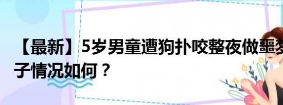 【最新】5岁男童遭狗扑咬整夜做噩梦 目前孩子情况如何？